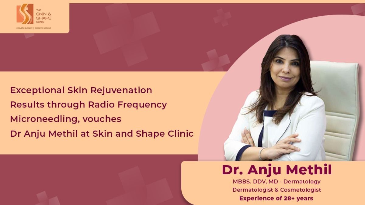 Exceptional Skin Rejuvenation Results through Radio Frequency Microneedling, vouches Dr. Anju Methil, Skin and Shape Clinic - PNN Digital